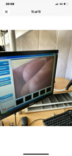 Load image into Gallery viewer, FuturEnt Endoscop
