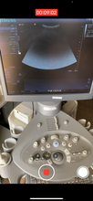 Load image into Gallery viewer, Siemens Acuson Antares
