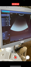 Load image into Gallery viewer, Siemens Acuson Antares
